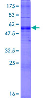 SLC35A1 Protein - 12.5% SDS-PAGE of human SLC35A1 stained with Coomassie Blue