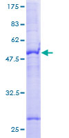 SLC35A2 / UGT Protein - 12.5% SDS-PAGE of human SLC35A2 stained with Coomassie Blue