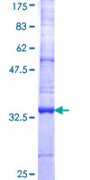 SLC35A2 / UGT Protein - 12.5% SDS-PAGE Stained with Coomassie Blue.