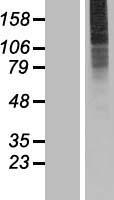 SLC35A3 Protein - Western validation with an anti-DDK antibody * L: Control HEK293 lysate R: Over-expression lysate