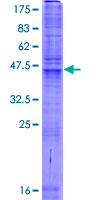 SLC35A3 Protein - 12.5% SDS-PAGE of human SLC35A3 stained with Coomassie Blue