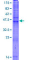 SLC35A3 Protein - 12.5% SDS-PAGE of human SLC35A3 stained with Coomassie Blue