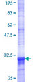 SLC35A3 Protein - 12.5% SDS-PAGE Stained with Coomassie Blue.