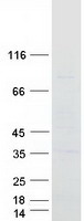 SLC35A4 Protein - Purified recombinant protein SLC35A4 was analyzed by SDS-PAGE gel and Coomassie Blue Staining