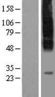 SLC35C1 Protein - Western validation with an anti-DDK antibody * L: Control HEK293 lysate R: Over-expression lysate