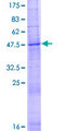 SLC35D2 Protein - 12.5% SDS-PAGE of human SLC35D2 stained with Coomassie Blue
