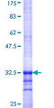 SLC35D2 Protein - 12.5% SDS-PAGE Stained with Coomassie Blue.