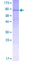 SLC35D3 / FRCL1 Protein - 12.5% SDS-PAGE of human SLC35D3 stained with Coomassie Blue