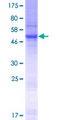 SLC35E2 Protein - 12.5% SDS-PAGE of human SLC35E2 stained with Coomassie Blue