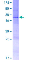 SLC35E4 Protein - 12.5% SDS-PAGE of human SLC35E4 stained with Coomassie Blue