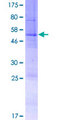 SLC35E4 Protein - 12.5% SDS-PAGE of human SLC35E4 stained with Coomassie Blue