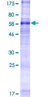 SLC35F2 Protein - 12.5% SDS-PAGE of human SLC35F2 stained with Coomassie Blue