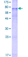SLC35F3 Protein - 12.5% SDS-PAGE of human SLC35F3 stained with Coomassie Blue