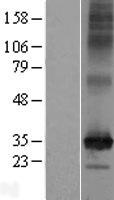 SLC35F6 Protein - Western validation with an anti-DDK antibody * L: Control HEK293 lysate R: Over-expression lysate