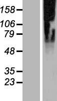SLC35G2 Protein - Western validation with an anti-DDK antibody * L: Control HEK293 lysate R: Over-expression lysate