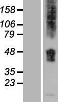 SLC36A1 Protein - Western validation with an anti-DDK antibody * L: Control HEK293 lysate R: Over-expression lysate