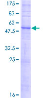 SLC36A2 Protein - 12.5% SDS-PAGE of human SLC36A2 stained with Coomassie Blue