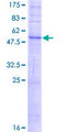 SLC36A2 Protein - 12.5% SDS-PAGE of human SLC36A2 stained with Coomassie Blue