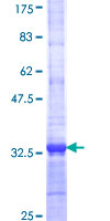 SLC36A2 Protein - 12.5% SDS-PAGE Stained with Coomassie Blue.