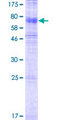 SLC37A3 Protein - 12.5% SDS-PAGE of human SLC37A3 stained with Coomassie Blue
