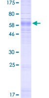 SLC37A4 / G6PT Protein - 12.5% SDS-PAGE of human SLC37A4 stained with Coomassie Blue