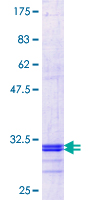 SLC37A4 / G6PT Protein - 12.5% SDS-PAGE Stained with Coomassie Blue.