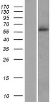 SLC38A2 / SNAT2 Protein - Western validation with an anti-DDK antibody * L: Control HEK293 lysate R: Over-expression lysate