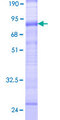 SLC38A3 / SNAT3 Protein - 12.5% SDS-PAGE of human SLC38A3 stained with Coomassie Blue