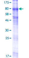 SLC38A4 / SNAT4 Protein - 12.5% SDS-PAGE of human SLC38A4 stained with Coomassie Blue