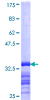 SLC38A4 / SNAT4 Protein - 12.5% SDS-PAGE Stained with Coomassie Blue.