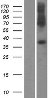 SLC39A1 Protein - Western validation with an anti-DDK antibody * L: Control HEK293 lysate R: Over-expression lysate