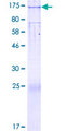 SLC39A10 / ZIP10 Protein - 12.5% SDS-PAGE of human SLC39A10 stained with Coomassie Blue