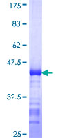 SLC39A10 / ZIP10 Protein - 12.5% SDS-PAGE Stained with Coomassie Blue.