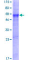 SLC39A11 / ZIP11 Protein - 12.5% SDS-PAGE of human SLC39A11 stained with Coomassie Blue