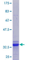SLC39A13 / ZIP13 Protein - 12.5% SDS-PAGE Stained with Coomassie Blue.
