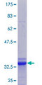 SLC39A13 / ZIP13 Protein - 12.5% SDS-PAGE Stained with Coomassie Blue.