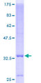 SLC39A3 / ZIP3 Protein - 12.5% SDS-PAGE of human SLC39A3 stained with Coomassie Blue