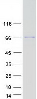 SLC39A4 / ZIP4 Protein - Purified recombinant protein SLC39A4 was analyzed by SDS-PAGE gel and Coomassie Blue Staining
