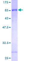 SLC39A5 / ZIP5 Protein - 12.5% SDS-PAGE of human SLC39A5 stained with Coomassie Blue