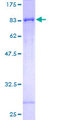 SLC39A5 / ZIP5 Protein - 12.5% SDS-PAGE of human SLC39A5 stained with Coomassie Blue