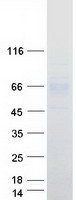 SLC39A5 / ZIP5 Protein - Purified recombinant protein SLC39A5 was analyzed by SDS-PAGE gel and Coomassie Blue Staining