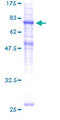 SLC39A7 / ZIP7 Protein - 12.5% SDS-PAGE of human SLC39A7 stained with Coomassie Blue