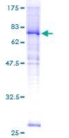 SLC39A7 / ZIP7 Protein - 12.5% SDS-PAGE of human SLC39A7 stained with Coomassie Blue