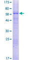 SLC39A8 / ZIP8 Protein - 12.5% SDS-PAGE of human SLC39A8 stained with Coomassie Blue