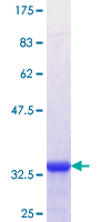SLC39A8 / ZIP8 Protein - 12.5% SDS-PAGE Stained with Coomassie Blue.