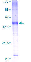 SLC39A9 Protein - 12.5% SDS-PAGE of human SLC39A9 stained with Coomassie Blue