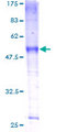 SLC39A9 Protein - 12.5% SDS-PAGE of human SLC39A9 stained with Coomassie Blue