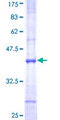SLC3A1 / ATR1 Protein - 12.5% SDS-PAGE Stained with Coomassie Blue.