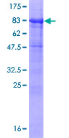 SLC3A2 / CD98 Heavy Chain Protein - 12.5% SDS-PAGE of human SLC3A2 stained with Coomassie Blue