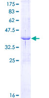 SLC3A2 / CD98 Heavy Chain Protein - 12.5% SDS-PAGE Stained with Coomassie Blue.